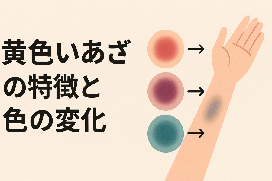 青・紫・黄 」そのあざの色危険かも！専門家があざの色、種類について徹底解説！ - 長原環七通り接骨院