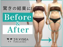 9月最新 二の腕痩せエステおすすめ7選！効果や安さなど口コミ評価が高いのは？LAURIER BEAUTY