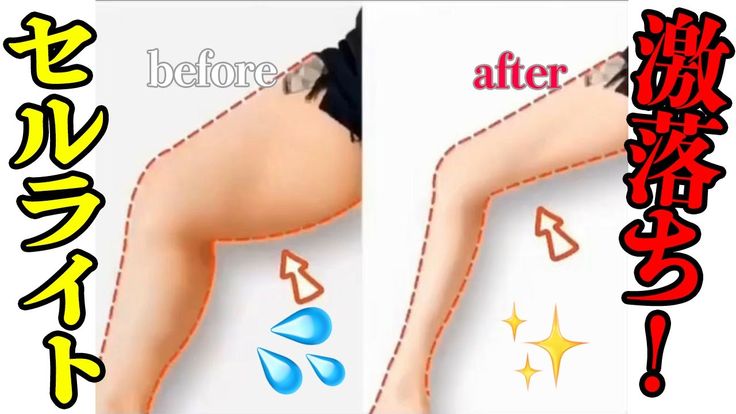 シェイプウェア ボディの下着、腹部の腰と腰を細くする一体のシェーギーの姿勢の形を整形する 弾力感色 : ベージュ, Size :Amazon.co.jp: しっかりとしたコントロールシェイプウェア ボディの下着、腹部の腰と腰を細くする一体のシェーギーの姿勢の形を整形する