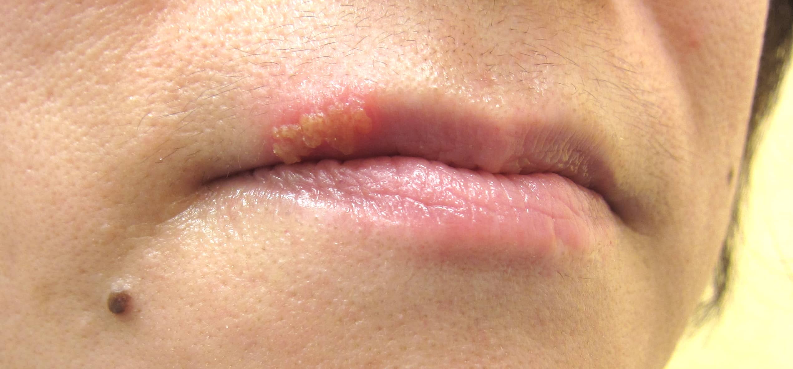 サブチーフ加藤がお贈りする唇ケアー！三越前駅小伝馬町歯科 ハルデンタルオフィス