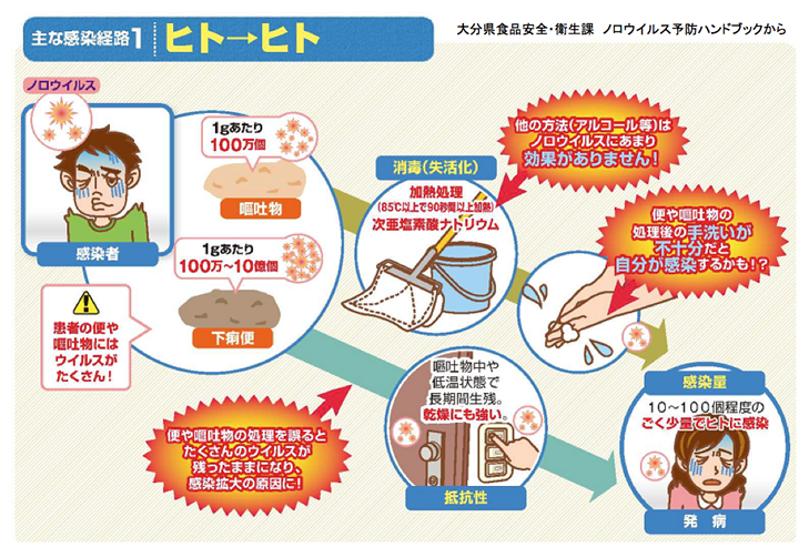 大流行か、新型ノロウイルス まず手洗いを徹底 - 日本経済新聞