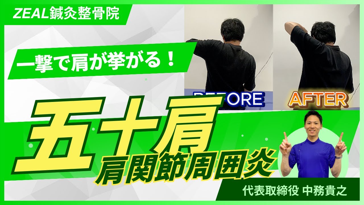 棘上靭帯炎 - 倉敷市ジール鍼灸整骨院 整体院