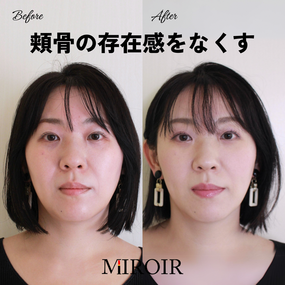 優しい顔になる方法 芸能人を参考に「特徴」や「メイクのポイント」「表情の作り方」まで解説！LIPS