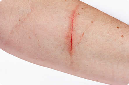 フルコートｆ田辺三菱製薬