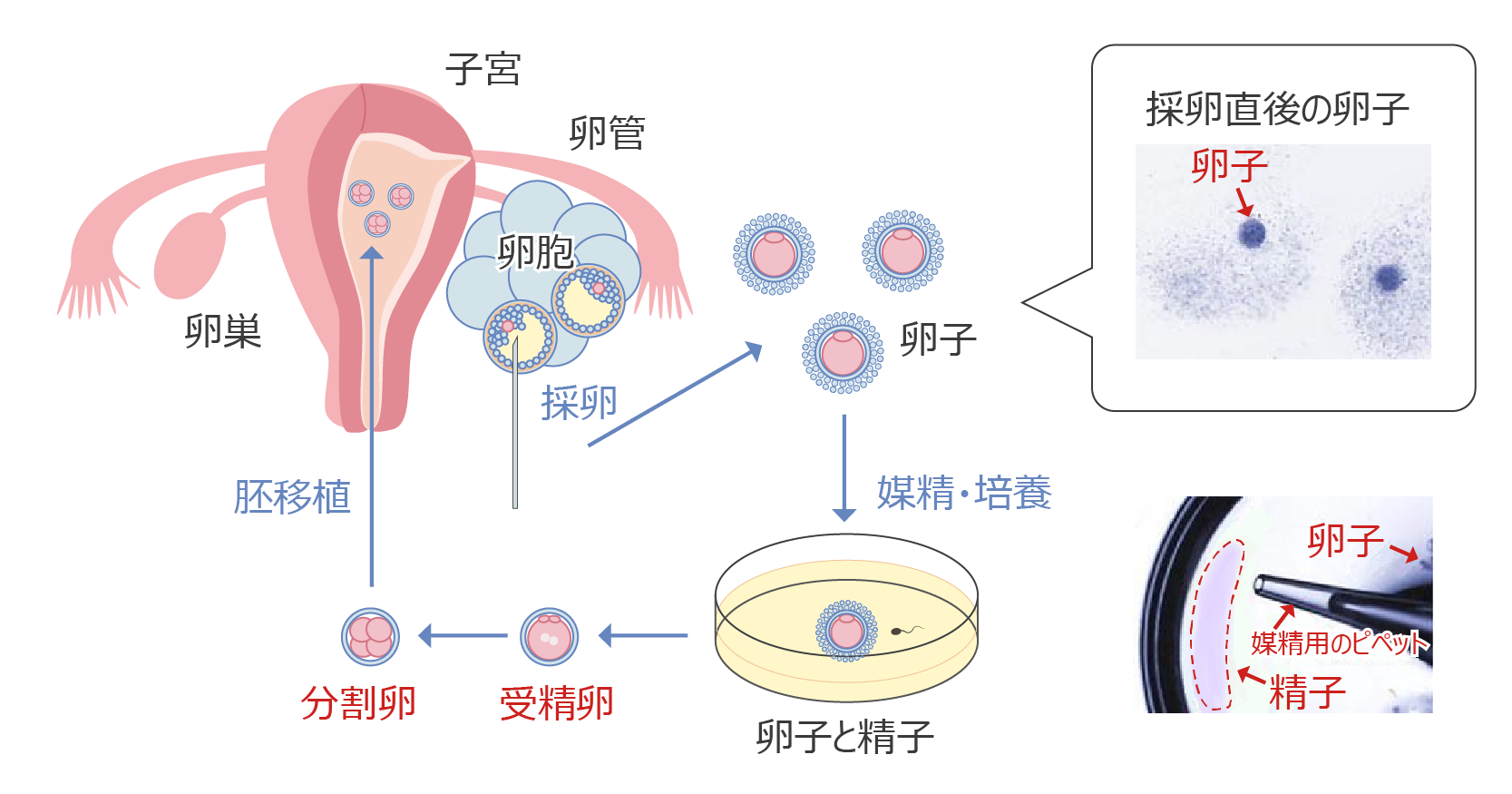体外受精│診療科目│キネマアートクリニック│東京都大田区にある不妊症、不妊治療、体外受精 ART など不妊治療の専門クリニック