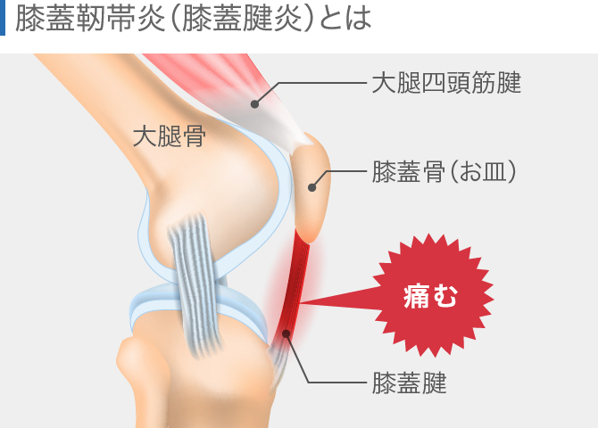 膝崩れについて - 銀座そうぜん鍼灸院 深層筋・自律神経 銀座・築地