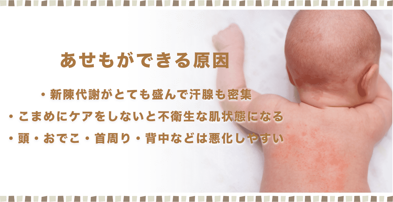 3枚セット 汗取りパッド 赤ちゃん ベビー 背中 セット 汗とりパッド 子ども 幼児 新生児 男の子 女の子 寝汗 汗 汗疹 綿100 羽 可愛い 夏ギフト おしゃれ : ベビー服とルームウェアのHishop - 通販 - Yahoo!ショッピング