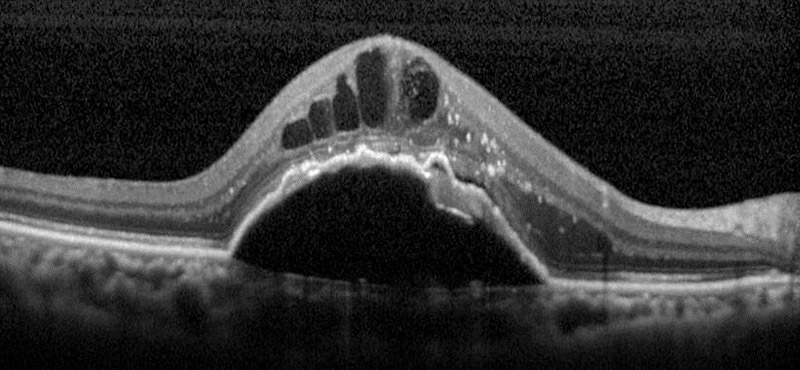 血液内科昭和医科大学病院