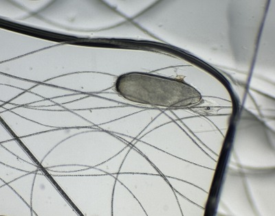 犬の寄生虫について知っておきたいこと：種類・症状・対処法ぽちたま薬局スタッフブログ