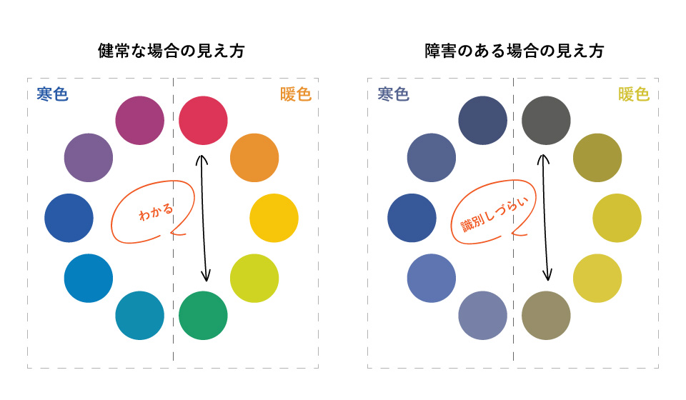 宮内 光膝下競技義足のアウター多摩美術大学