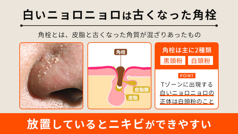 鼻の毛穴に目立つ黒い塊とは？原因と正しい取り方、おすすめ角栓対策についても解説コラム公式 マナラ化粧品