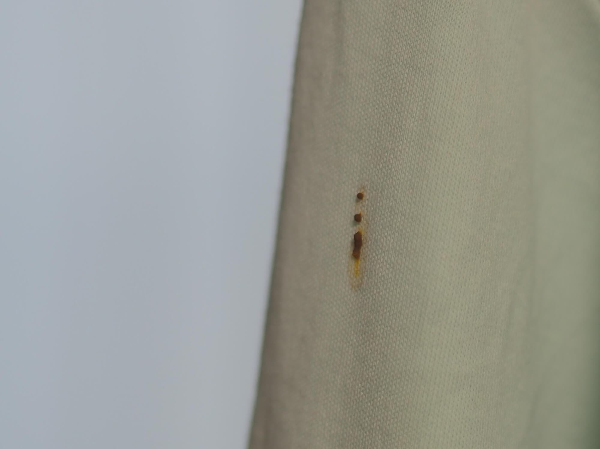 蜂に２回刺されると危険！アナフィラキシーショックとは