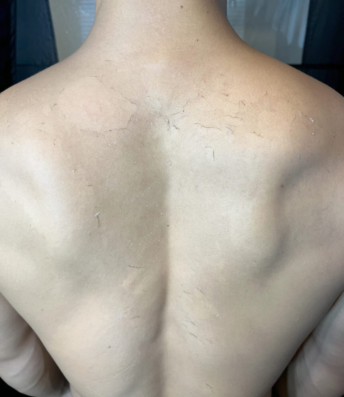 ヘアアートの日焼け後King's New Head