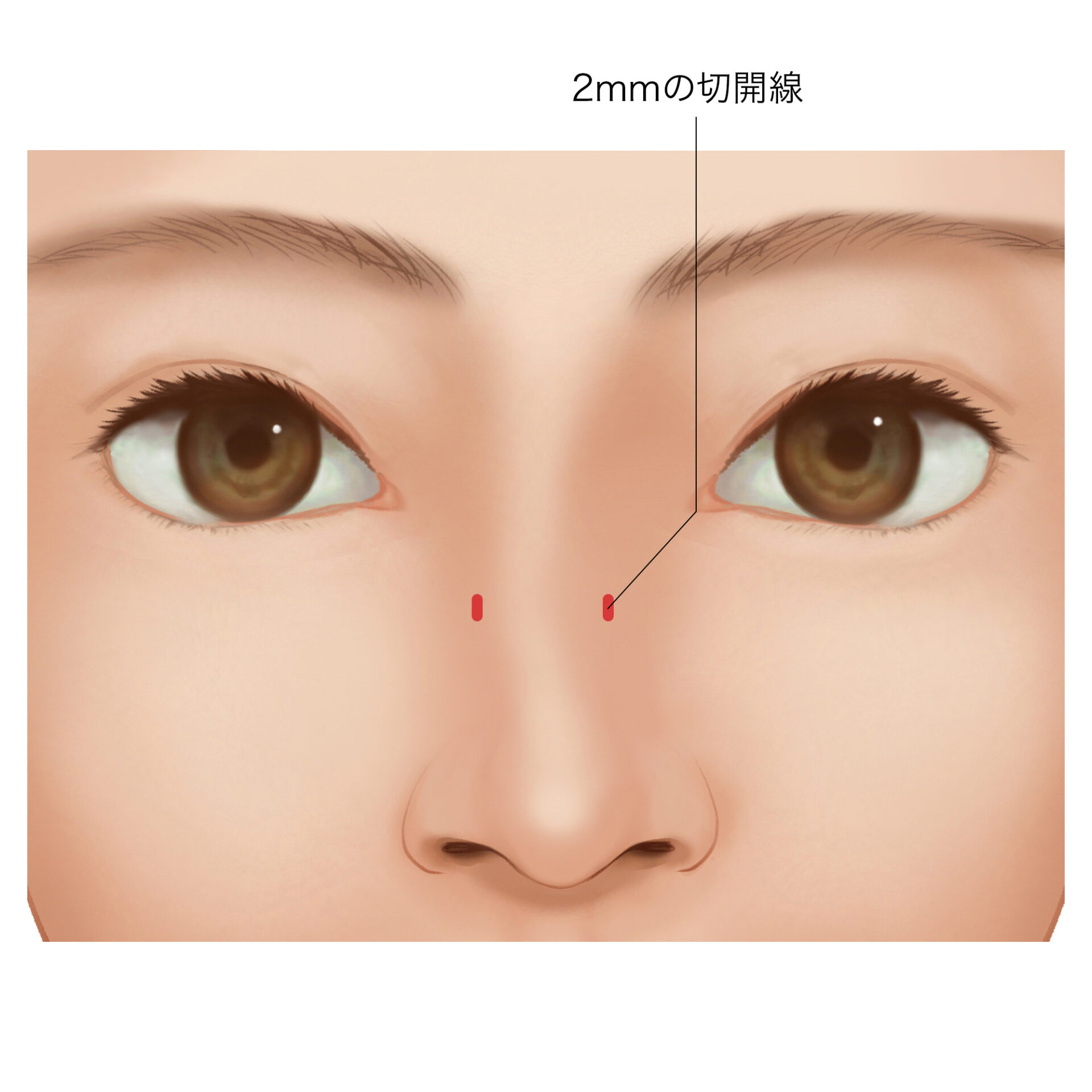 斜鼻変形・鼻の曲がり・鼻中隔弯曲症の治療受け口などの顎変形症、あごえら・小顔矯正・性同一性障害の顔面輪郭、鼻整形、顔面変形、睡眠時無呼吸症候群の形成美容外科専門治療：東京警察病院形成外科・美容外科