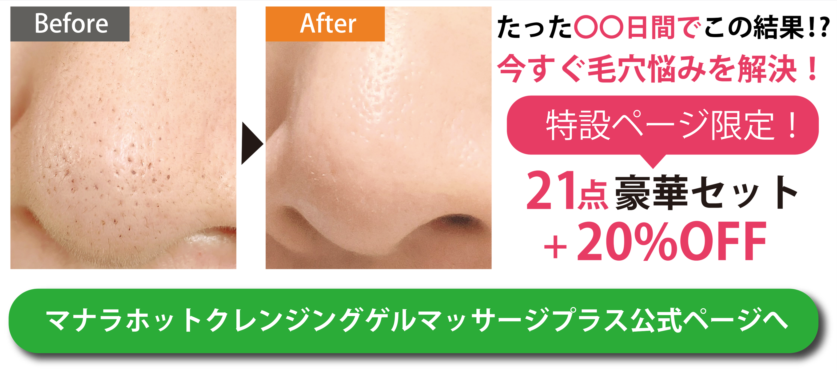 角栓の取り方 詰まる原因と正しい除去＆ケア方法最新おすすめアイテム美的.com