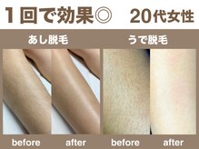 フェイシャルエステ人気・デコルテマッサージはフェイシャルの基本！スリーグランツエステサロン山口県周南市