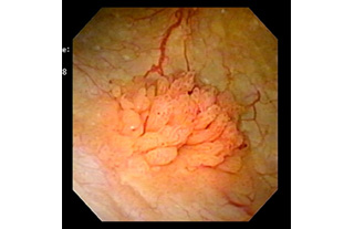 膀胱腫瘍・膀胱炎八王子駅近くの泌尿器科 - 八王子市