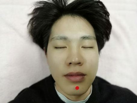 役に立つツボ：口が乾きやすくなったらこのツボ『俠承漿』藤田はりきゅう治療院豊明市で身体の悩みを鍼灸で改善