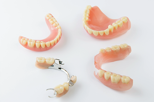 多数歯の欠損がある場合、ブリッジによる治療は持ちが悪い！東京・神田、日本橋で審美歯科、矯正歯科 、精密根管治療、インプラント治療なら「神田デンタルケアクリニック」