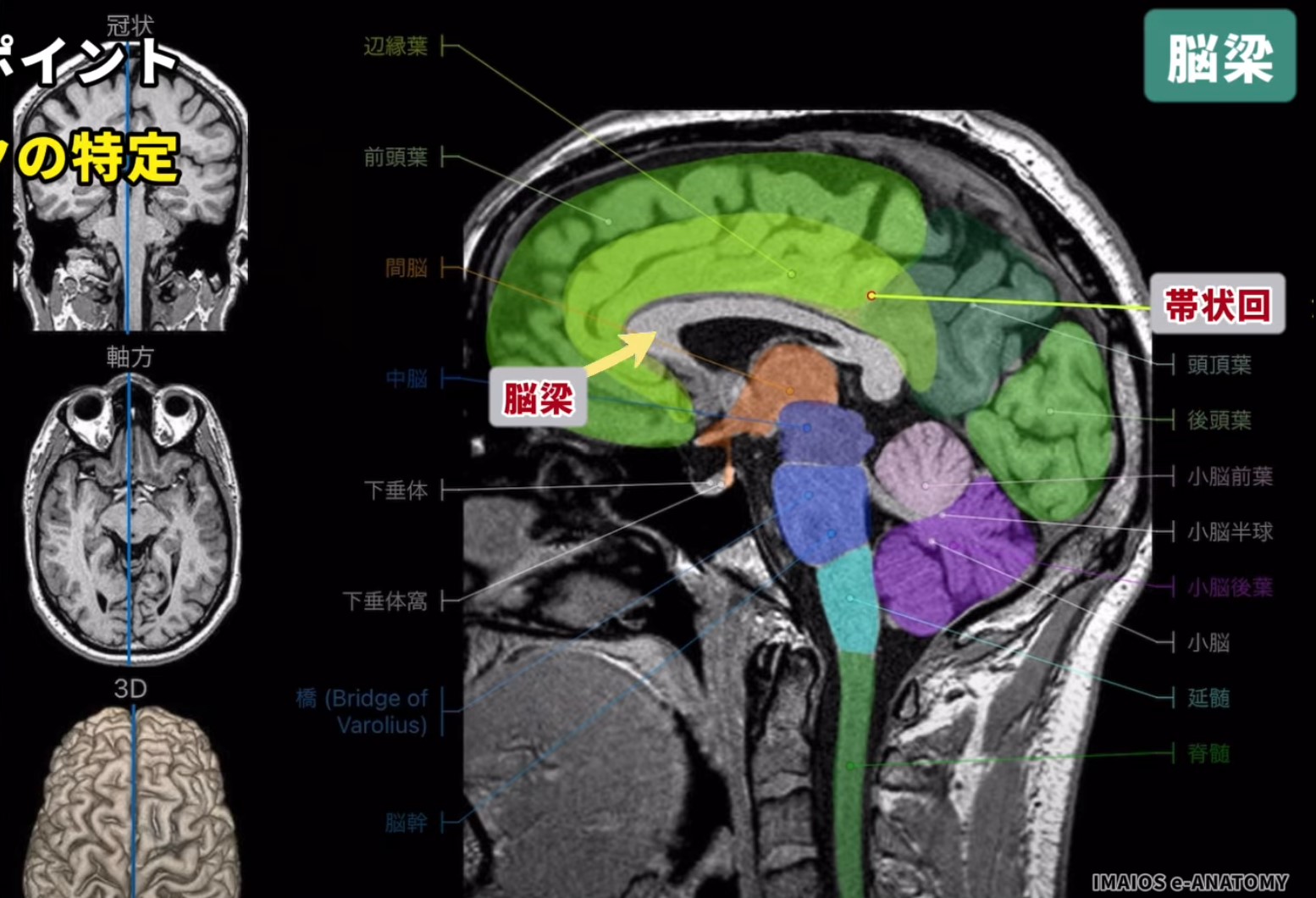 2025年版 帯状回を徹底解説！役割〜痛みと認知的アプローチによるリハビリ成功のカギ – STROKE LAB 東京 大阪 自費リハビリ脳卒中 神経系