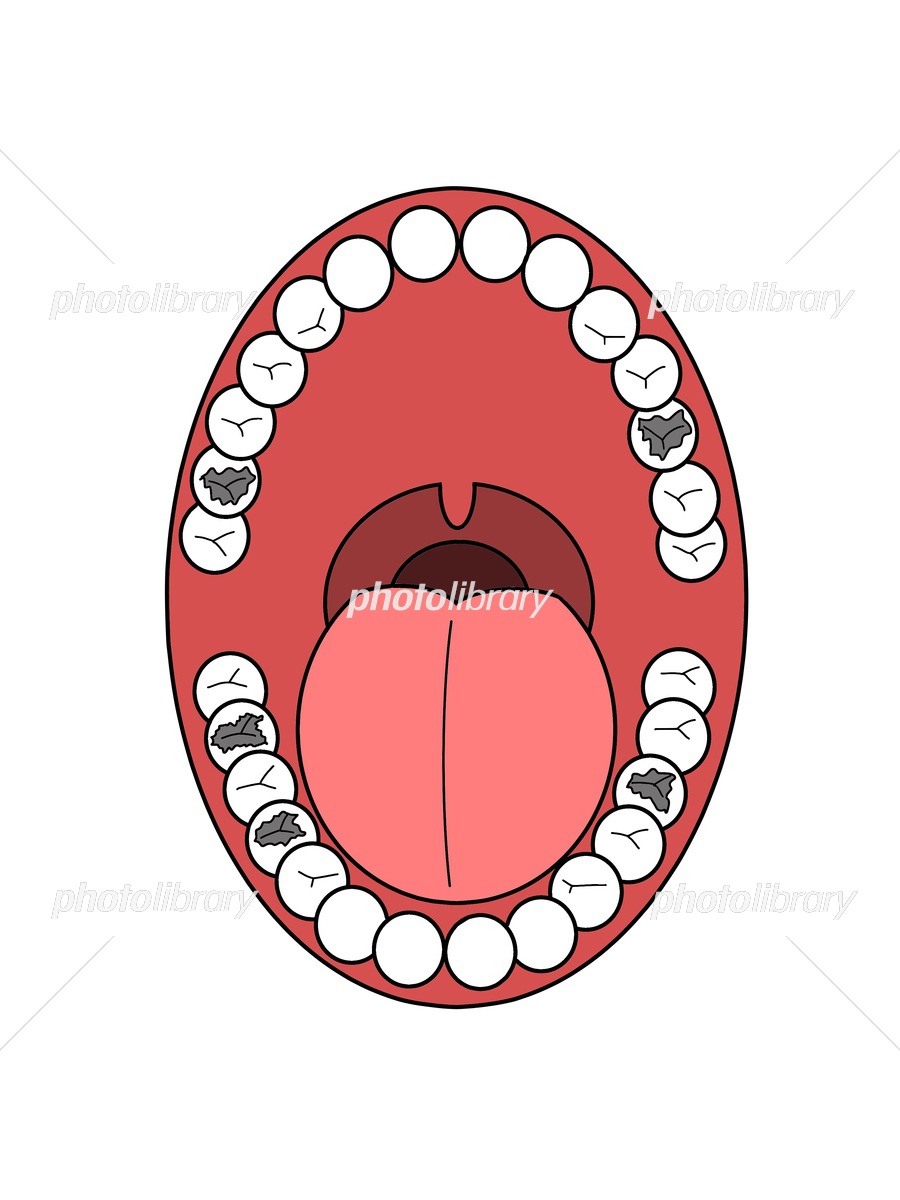 たゆたう、カジュアル萌えシミュレーションゲーム『歯みがき彼女◇Cavity Kanojo』を配信開始 美少女の口の中の虫歯菌を取り除いてあげよう！gamebiz