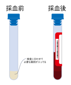 採血スピッツの順番がパッとわかる！根拠、採血管の種類も解説看護roo! カンゴルー