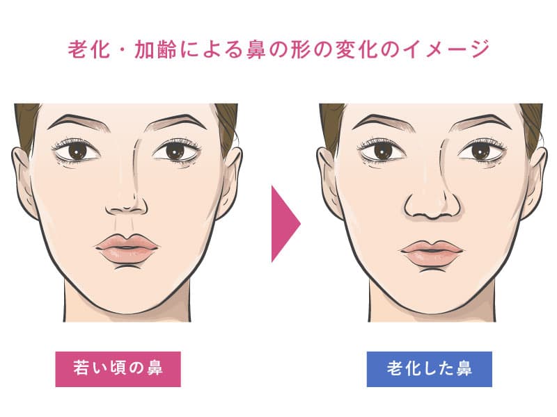 頭蓋骨痩せ」がシワ・たるみの原因に？大阪・梅田の医療脱毛ミセルクリニック 公式