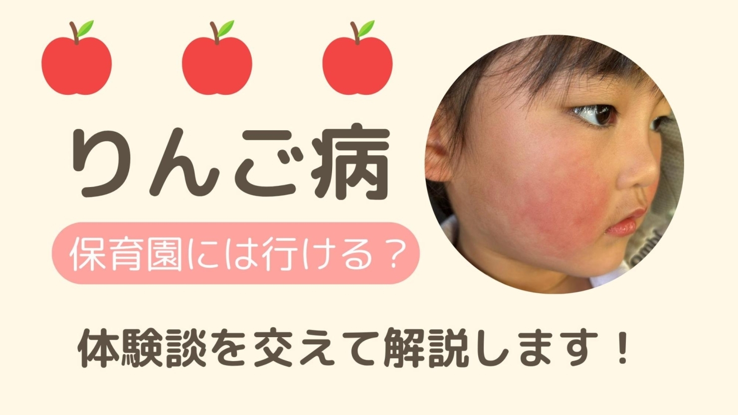 りんご病 伝染性紅斑 子ども医学館妊娠・出産・育児に関する総合情報サイト ベビカム