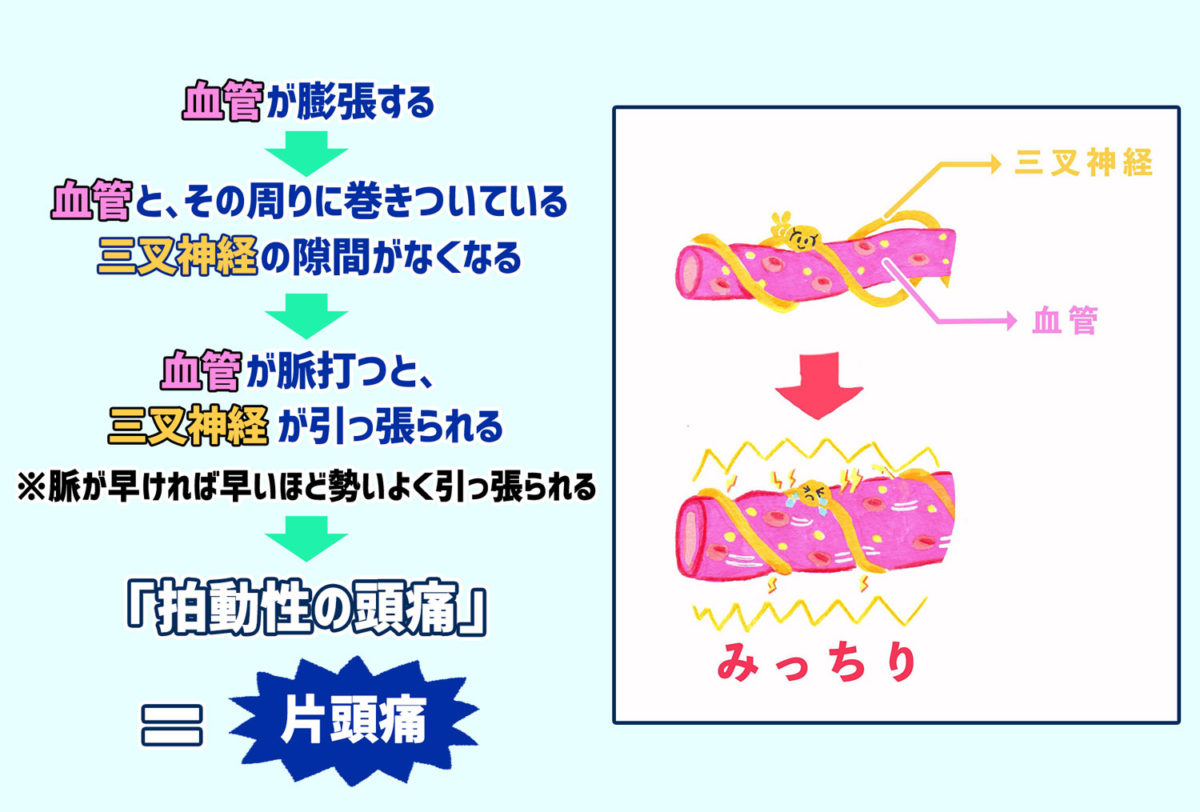 ズキッ！その痛み、夏の頭痛かもしれません！美しさを満たす美容コラム特集 belta piu ベルタピウライスフォース＜公式＞オンラインショップ「今こそ本質的な美しさへ」