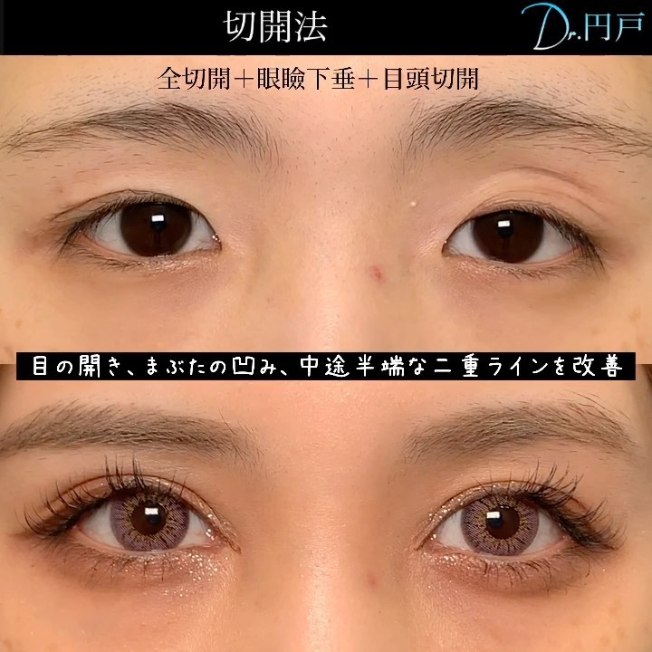 ＼美容部員直伝一重＆奥二重さん向け！目を大きく見せるメイク方法👀, 垢抜けメイクが得意あやや@ayaya_shiseido が,一重＆奥二重さん向けに目もとをもっと魅力的に見せるコツを解説✨, ぜひ参考にしてみてね💎,資生堂美容部員資生堂パーソナルビューティーパートナー SHISEIDOアイシャドウメイク方法初心者メイク一重メイク奥二重メイク