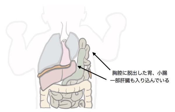 しゃっくりの止め方とは？長時間止まらない場合の対処法を解説みんなでつくる！暮らしのマネーメディア みんなのマネ活