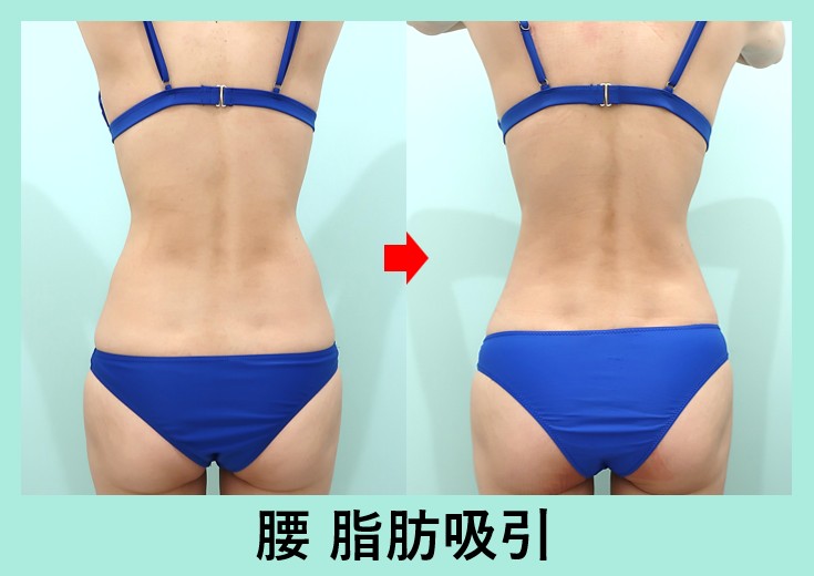 オンラインコーチング 有酸素無しで痩せられた事に驚きです。食事管理の大切さを痛感しました。澤原魁門フィジーク日本一の減量＆ボディメイク戦略