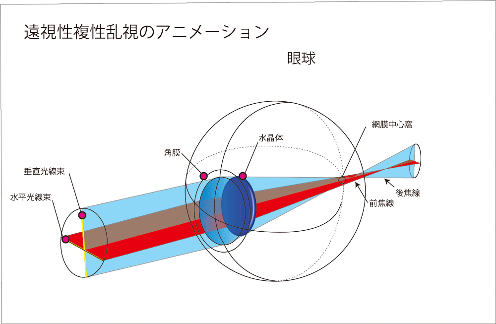 オルソケラトロジー眼科わじま医院