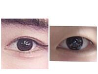 アイプチと埋没法すっぴん女医 Dr.CHIHOの美容ブログ