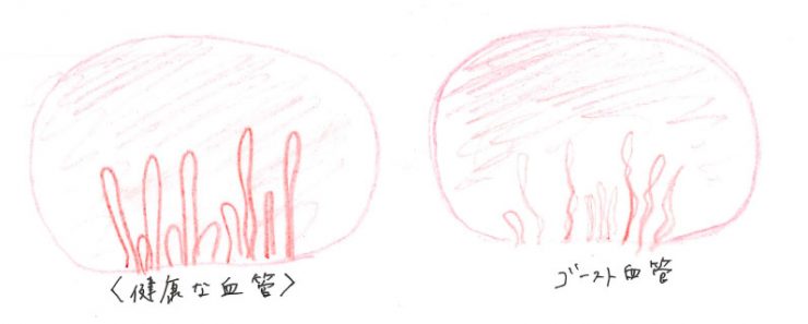 ポリフェノール豊富なルイボスティー 痛風にも効果 - 日本経済新聞