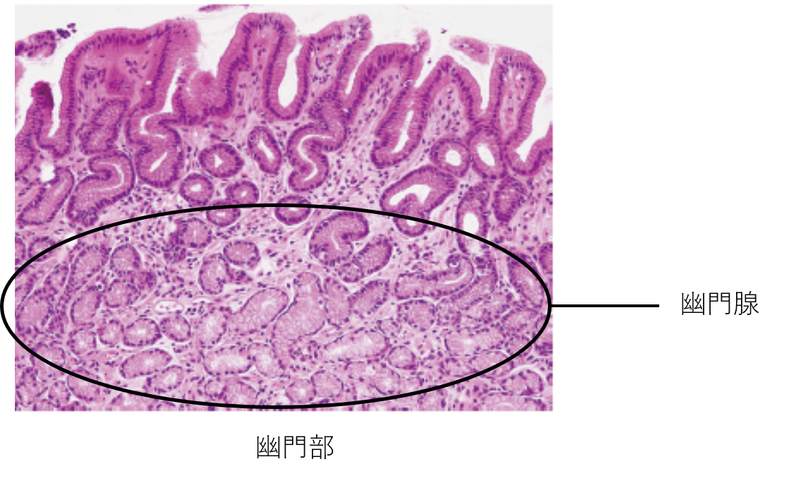 胃がん山口大学大学院医学系研究科 消化器・腫瘍外科学