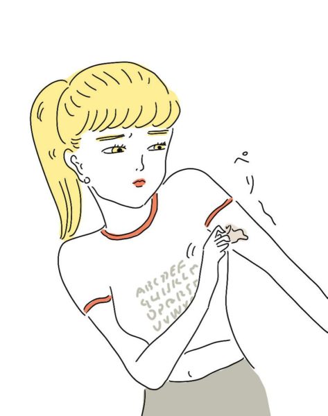 日焼けしたあとに皮膚がむけてしまった女性の腕のアップの写真素材58037206- PIXTA