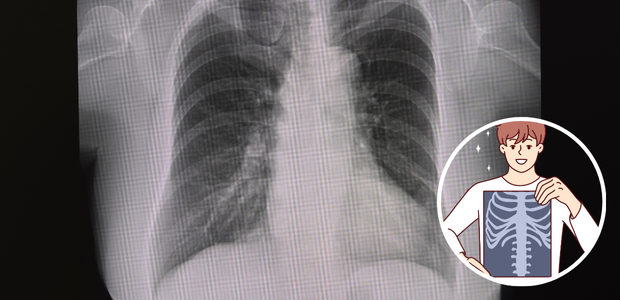 無気肺の種類や症状、検査、治療について - 日ノ出町呼吸器内科・内科クリニックブログ