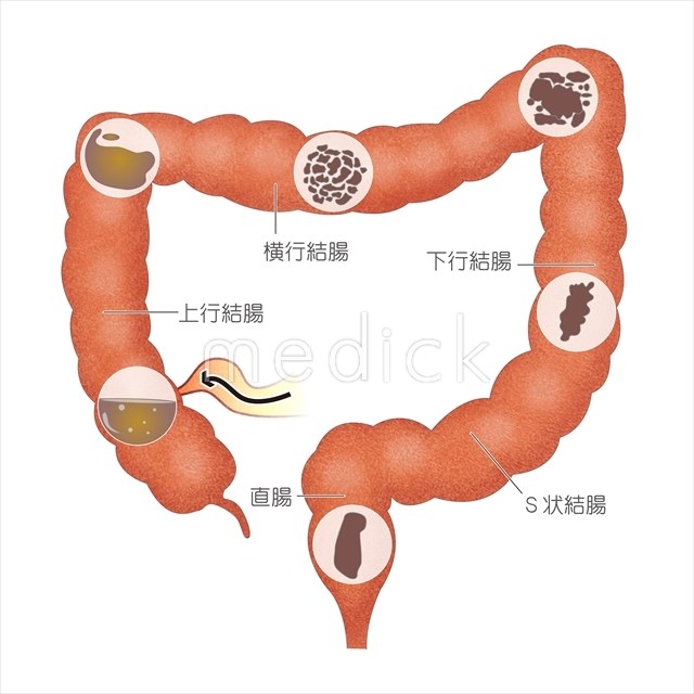 健康な大腸のイラスト無料のフリー素材 イラストエイト