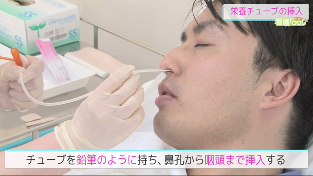 はじめての方へ 経鼻経管栄養の特徴と自宅介護の注意点 - LIFULL 介護 ライフル介護