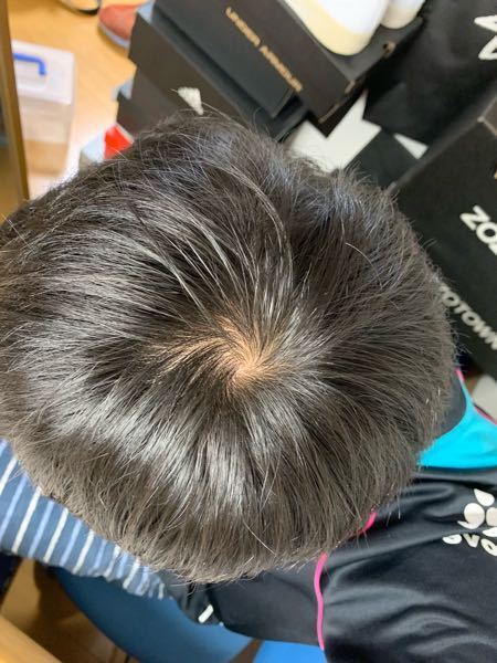 メンズのつむじ: 割れぐせ改善とボリュームアップ方法