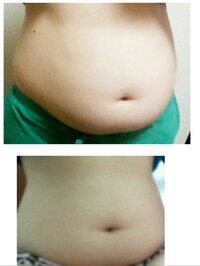 急にわきがになることはある！？突然臭いが気になり始めた原因や対処法をご紹介公式コラム美容整形・二重整形なら共立美容外科