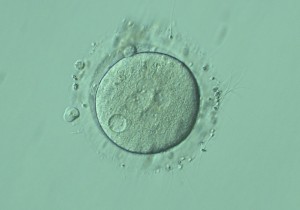 体外受精と顕微授精の受精率は？ 〜受精方法選択の基準〜産婦人科クリニックさくら