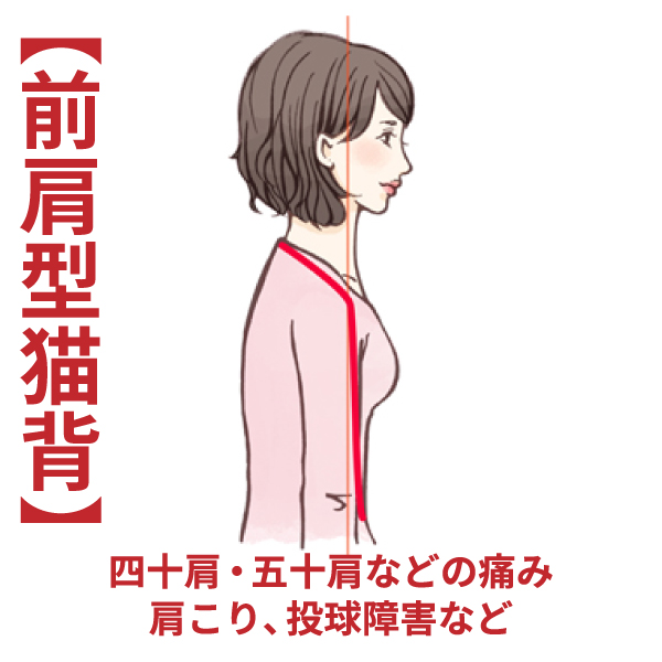 姿勢矯正 整体 治療 - 長崎市浜の町の整体なら 姿勢矯正HOGUS ぎんやまち整骨院