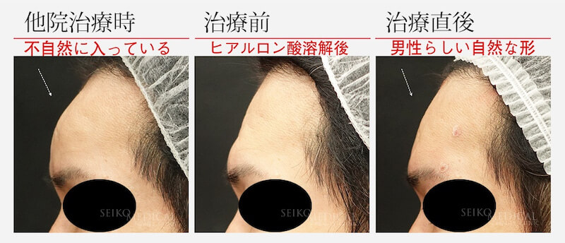 えいりー 💄🖤フォロバ on LIPS 「 ロムアンド ティントはデコって持ち歩こう💗´-」LIPS