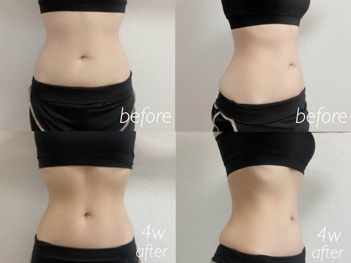 短期間で体重を落とす！1週間で5キロ痩せる効果的なダイエット方法 - バウム美容外科