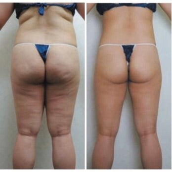 コンプレックスを一瞬で消したデカいお尻の話鈴鹿久美子