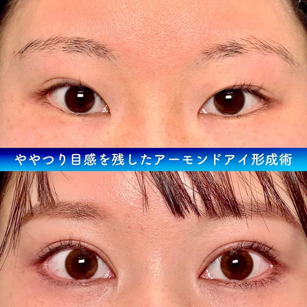 目の形、瞳の形。あたらしいメガネの選び方 ～Seacret Remedy～ ニュース＆ブログ 吉祥寺 三鷹、荻窪 のメガネ 眼鏡,めがね セレクトショップGLASSTORY IKARA グラストリーイカラ