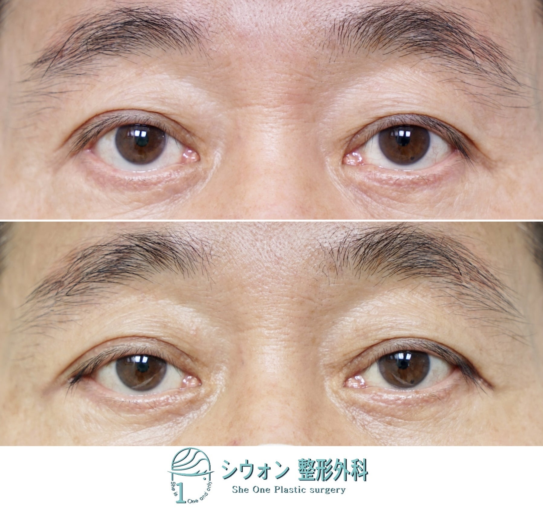 三白眼の人に似合うカラコン特集！白目が透けない＆盛れるナチュラル系カラコンはコレだ！ –公式 カラコンビフォーアフター～カラコンレポ・レビュー・装着画像 600種類以上！～