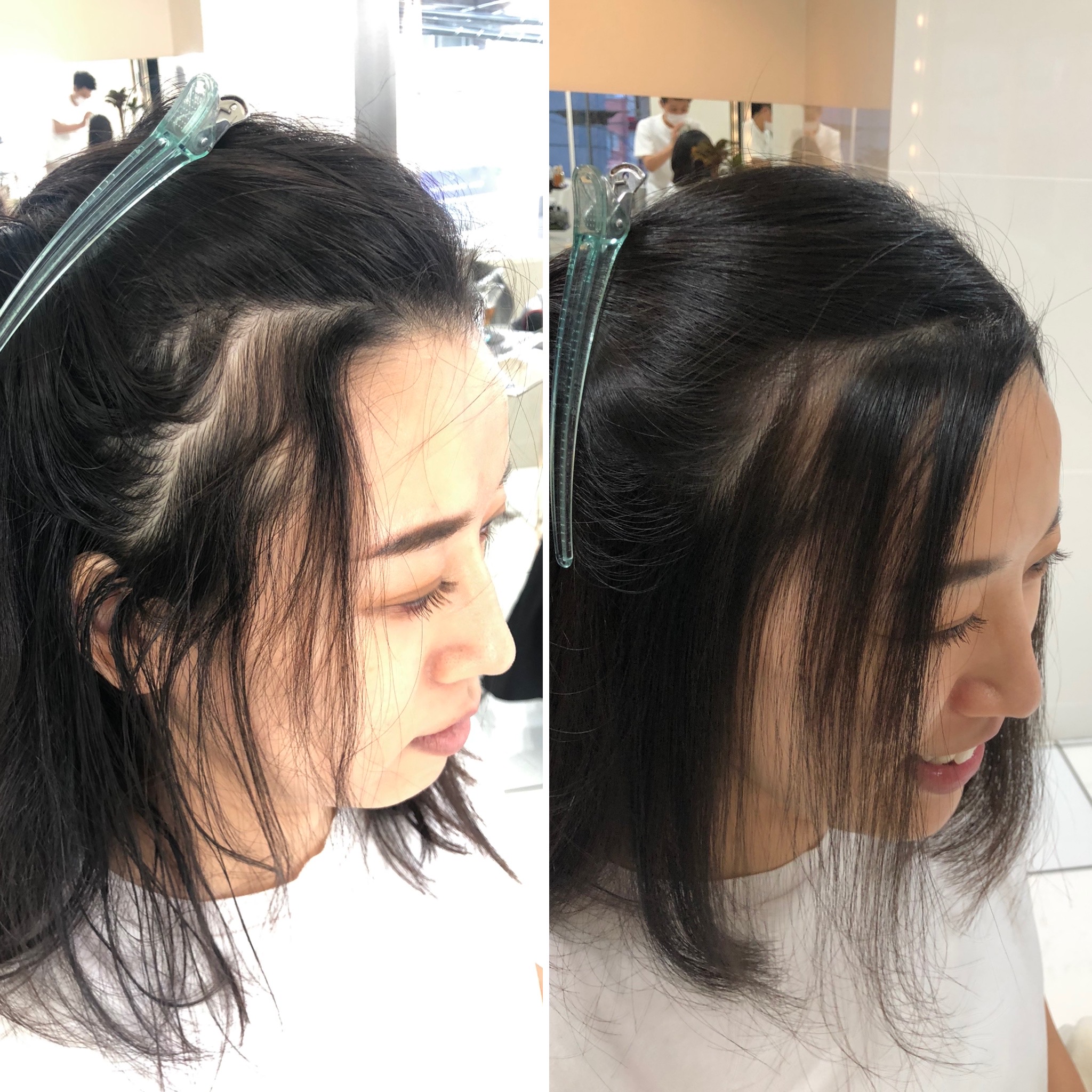 女性の生え際、こめかみ隙間問題。CHARA池袋本店 キャラ池袋